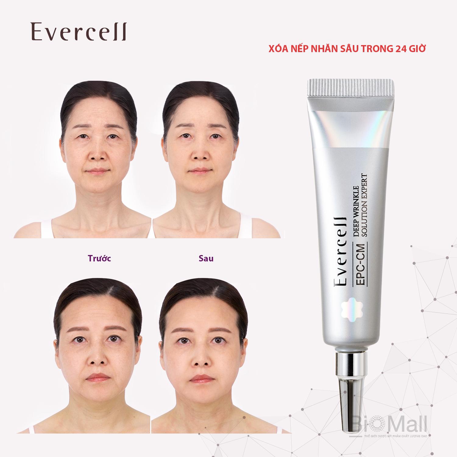 Evercell Deep Wrinkle Solution Expert 10ml